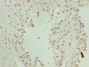 Goat polyclonal to rabbit IgG at 1/50000 dilution