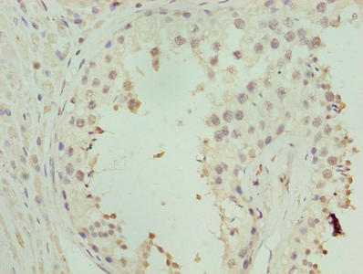 Goat polyclonal to rabbit IgG at 1/50000 dilution
