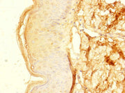Immunohistochemistry of paraffin-embedded human skin tissue using CSB-PA026804LA01HU at dilution of 1:100