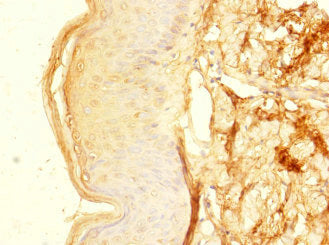 Immunohistochemistry of paraffin-embedded human skin tissue using CSB-PA026804LA01HU at dilution of 1:100