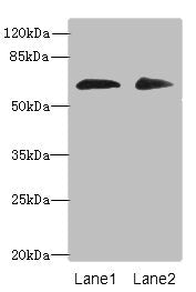 Western blot All lanes: ZNF529 antibody at 6µg/ml Lane 1: Hela whole cell lysate Lane 2: MCF-7 whole cell lysate Secondary Goat polyclonal to rabbit IgG at 1/10000 dilution Predicted band size: 66 kDa Observed band size: 66 kDa