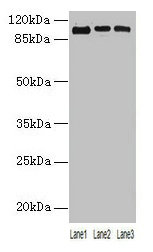 Western blot All lanes: ZNF546 antibody at 4µg/ml Lane 1: A549 whole cell lysate Lane 2: 293T whole cell lysate Lane 3: Hela whole cell lysate Secondary Goat polyclonal to rabbit IgG at 1/10000 dilution Predicted band size: 99 kDa Observed band si...