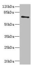 Western blot All lanes: ZNF549 antibody at 1.09µg/ml + A549 whole cell lysate Secondary Goat polyclonal to rabbit IgG at 1/10000 dilution Predicted band size: 75, 73 kDa Observed band size: 75 kDa