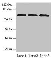 Western blot All lanes: ZNF554 antibody at 5µg/ml Lane 1: K562 whole cell lysate Lane 2: U937 whole cell lysate Lane 3: A549 whole cell lysate Secondary Goat polyclonal to rabbit IgG at 1/10000 dilution Predicted band size: 61 kDa Observed band si...