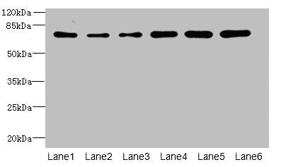 Western blot All lanes: ZNF555 antibody at 2µg/ml Lane 1: HepG2 whole cell lysate Lane 2: 293T whole cell lysate Lane 3: Hela whole cell lysate Lane 4: Jurkat whole cell lysate Lane 5: Mouse liver tissue Lane 6: HL60 whole cell lysate Secondary Go...