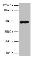 Western blot All lanes: ZNF562 antibody at 12µg/ml + 293T whole cell lysate Secondary Goat polyclonal to rabbit IgG at 1/10000 dilution Predicted band size: 49, 41 kDa Observed band size: 49 kDa