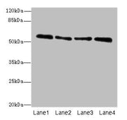 Western blot All lanes: ZNF563 antibody at 7µg/ml Lane 1: Hela whole cell lysate Lane 2: A549 whole cell lysate Lane 3: MCF-7 whole cell lysate Lane 4: K562 whole cell lysate Secondary Goat polyclonal to rabbit IgG at 1/10000 dilution Predicted ba...