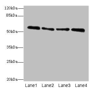 Western blot All lanes: ZNF563 antibody at 7µg/ml Lane 1: Hela whole cell lysate Lane 2: A549 whole cell lysate Lane 3: MCF-7 whole cell lysate Lane 4: K562 whole cell lysate Secondary Goat polyclonal to rabbit IgG at 1/10000 dilution Predicted ba...