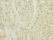 Immunohistochemistry of paraffin-embedded human kidney tissue using CSB-PA026876LA01HU at dilution of 1:100