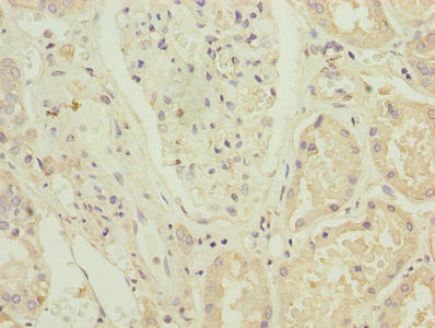 Immunohistochemistry of paraffin-embedded human kidney tissue using CSB-PA026876LA01HU at dilution of 1:100