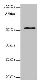 Western blot All lanes: ZNF610 antibody at 7µg/ml + MCF-7 whole cell lysate Secondary Goat polyclonal to rabbit IgG at 1/10000 dilution Predicted band size: 54, 49 kDa Observed band size: 54 kDa