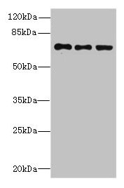 Western blot All lanes: ZNF614 antibody at 6µg/ml Lane 1: Jurkat whole cell lysate Lane 2: HepG2 whole cell lysate Lane 3: A549 whole cell lysate Secondary Goat polyclonal to rabbit IgG at 1/10000 dilution Predicted band size: 68, 23 kDa Observed...
