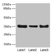 Western blot All lanes: ZNF625 antibody at 4µg/ml Lane 1: Mouse brain tissue Lane 2: Mouse lung tissue Lane 3: Mouse ovarian tissue Secondary Goat polyclonal to rabbit IgG at 1/10000 dilution Predicted band size: 35, 43 kDa Observed band size: 35 kDa