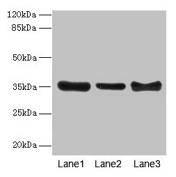 Western blot All lanes: ZNF625 antibody at 4µg/ml Lane 1: Mouse brain tissue Lane 2: Mouse lung tissue Lane 3: Mouse ovarian tissue Secondary Goat polyclonal to rabbit IgG at 1/10000 dilution Predicted band size: 35, 43 kDa Observed band size: 35 kDa
