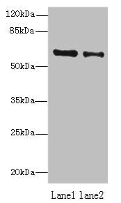 Western blot All lanes: ZNF626 antibody at 10µg/ml Lane 1: HepG2 whole cell lysate Lane 2: Raji whole cell lysate Secondary Goat polyclonal to rabbit IgG at 1/10000 dilution Predicted band size: 61, 53, 11 kDa Observed band size: 61 kDa