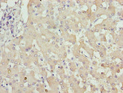 Immunohistochemistry of paraffin-embedded human liver tissue using CSB-PA026913LA01HU at dilution of 1:100