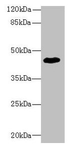 Western blot All lanes: ZNF670 antibody at 5µg/ml + HepG2 whole cell lysate Secondary Goat polyclonal to rabbit IgG at 1/10000 dilution Predicted band size: 45 kDa Observed band size: 45 kDa