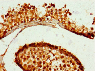 Immunohistochemistry of paraffin-embedded human testis tissue using CSB-PA026945LA01HU at dilution of 1:100