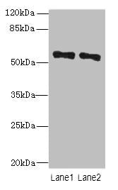 Western blot All lanes: ZNF689 antibody at 5µg/ml Lane 1: Hela whole cell lysate Lane 2: HepG2 whole cell lysate Secondary Goat polyclonal to rabbit IgG at 1/10000 dilution Predicted band size: 57 kDa Observed band size: 57 kDa