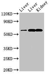 Western Blot Positive WB detected in: Rat liver tissue, Mouse liver tissue, Mouse kidney tissue All lanes: ZNF695 antibody at 3.4ug/ml Secondary Goat polyclonal to rabbit IgG at 1/50000 dilution Predicted band size: 61, 21, 16, 11 kDa Observed ban...