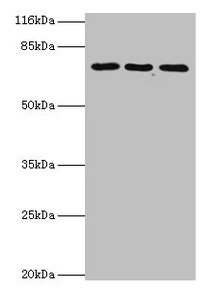 Western blot All lanes: ZNF699 antibody at 2µg/ml Lane 1: Jurkat whole cell lysate Lane 2: K562 whole cell lysate Lane 3: U87 whole cell lysate Secondary Goat polyclonal to rabbit IgG at 1/10000 dilution Predicted band size: 74 kDa Observed band s...