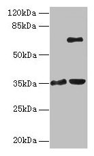 Western blot All lanes: ZNF75A antibody at 10µg/ml Lane 1: Mouse brain tissue Lane 2: Mouse liver tissue Secondary Goat polyclonal to rabbit IgG at 1/10000 dilution Predicted band size: 35 kDa Observed band size: 35, 65 kDa