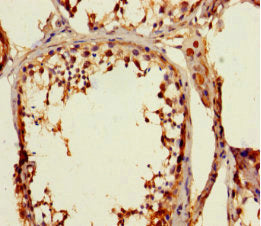 Immunohistochemistry of paraffin-embedded human testis tissue using CSB-PA027025LA01HU at dilution of 1:100