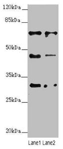 Western blot All lanes: ZNF785 antibody at 6.27ug/ml Lane 1: Hela whole cell lysate Lane 2: PC-3 whole cell lysate Secondary Goat polyclonal to rabbit IgG at 1/10000 dilution Predicted band size: 47, 45 kDa Observed band size: 47, 65, 30 kDa