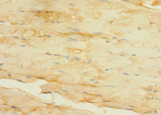 Immunohistochemistry of paraffin-embedded human skeletal muscle tissue using CSB-PA027047LA01HU at dilution of 1:100