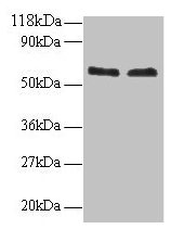 Western blot All lanes: FUS antibody at 2µg/ml Lane 1: 293T whole cell lysate Lane 2: EC109 whole cell lysate Secondary Goat polyclonal to rabbit IgG at 1/15000 dilution Predicted band size: 54 kDa Observed band size: 60 kDa