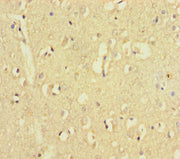 Immunohistochemistry of paraffin-embedded human brain tissue using CSB-PA027053LA01HU at dilution of 1:100