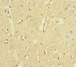 Immunohistochemistry of paraffin-embedded human brain tissue using CSB-PA027053LA01HU at dilution of 1:100