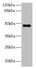 Western blot All lanes: ZNF821 antibody at 8µg/ml + MCF-7 whole cell lysate Secondary Goat polyclonal to rabbit IgG at 1/10000 dilution Predicted band size: 47, 43 kDa Observed band size: 47 kDa