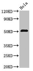 Western Blot Positive WB detected in: Hela whole cell lysate All lanes: ZNF829 antibody at 3µg/ml Secondary Goat polyclonal to rabbit IgG at 1/50000 dilution Predicted band size: 51, 29, 59 kDa Observed band size: 51 kDa