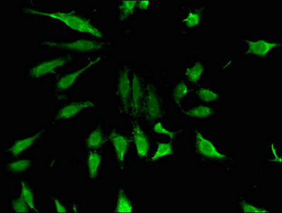 Immunofluorescent analysis of Hela cells using CSB-PA027106LA01HU at dilution of 1:100 and Alexa Fluor 488-congugated AffiniPure Goat Anti-Rabbit IgG(H+L)