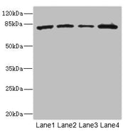 Western blot All lanes: ZP2 antibody at 3.06ug/ml Lane 1: 293T whole cell lysate Lane 2: Hela whole cell lysate Lane 3: Jurkat whole cell lysate Lane 4: HepG2 whole cell lysate Secondary Goat polyclonal to rabbit IgG at 1/10000 dilution Predicted...
