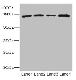 Western blot All lanes: ZP2 antibody at 3.06ug/ml Lane 1: 293T whole cell lysate Lane 2: Hela whole cell lysate Lane 3: Jurkat whole cell lysate Lane 4: HepG2 whole cell lysate Secondary Goat polyclonal to rabbit IgG at 1/10000 dilution Predicted...