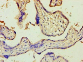 Immunohistochemistry of paraffin-embedded human placenta tissue using CSB-PA027127HA01HU at dilution of 1:100