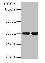 Western blot All lanes: ZBED1 antibody at 2µg/ml Lane 1: EC109 whole cell lysate Lane 2: 293T whole cell lysate Secondary Goat polyclonal to rabbit IgG at 1/15000 dilution Predicted band size: 79 kDa Observed band size: 35 kDa
