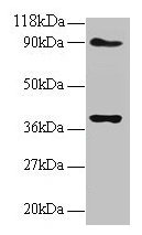 Western blot All lanes: NDUFS5 antibody at 2µg/ml Lane 1: EC109 whole cell lysate Lane 2: 293T whole cell lysate Secondary Goat polyclonal to rabbit IgG at 1/15000 dilution Predicted band size: 13 kDa Observed band size: 40 kDa