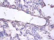 Immunohistochemistry of paraffin-embedded human lung tissue using CSB-PA02745A0Rb at dilution of 1:100