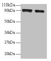 Western blot All lanes: SAT1 antibody at 2µg/ml Lane 1: 293T whole cell lysate Lane 2: EC109 whole cell lysate Secondary Goat polyclonal to rabbit IgG at 1/15000 dilution Predicted band size: 21 kDa Observed band size: 90 kDa