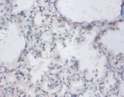 Immunohistochemistry of paraffin-embedded human lung tissue using CSB-PA02759A0Rb at dilution of 1:100