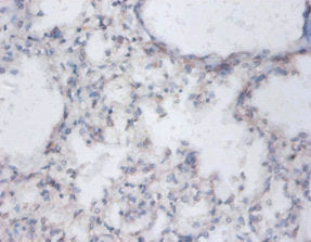 Immunohistochemistry of paraffin-embedded human lung tissue using CSB-PA02759A0Rb at dilution of 1:100