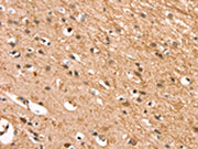 The image on the left is immunohistochemistry of paraffin-embedded Human brain tissue using CSB-PA027621(CSTB Antibody) at dilution 1/30, on the right is treated with synthetic peptide. (Original magnification: ×200)
