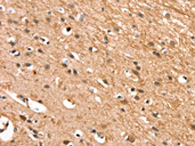 The image on the left is immunohistochemistry of paraffin-embedded Human brain tissue using CSB-PA027621(CSTB Antibody) at dilution 1/30, on the right is treated with synthetic peptide. (Original magnification: ×200)