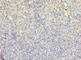 Immunohistochemistry of paraffin-embedded human tonsil tissue using CSB-PA02769A0Rb at dilution of 1:100