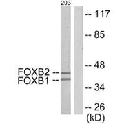 Western blot analysis of extracts from 293 cells, using FOXB1/2 antibody.