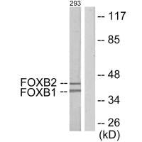 Western blot analysis of extracts from 293 cells, using FOXB1/2 antibody.