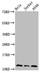 Western Blot Positive WB detected in: Hela whole cell lysate, Jurkat whole cell lysate, A549 whole cell lysate All lanes: TXN antibody at 3µg/ml Secondary Goat polyclonal to rabbit IgG at 1/50000 dilution Predicted band size: 12, 10 kDa Observed b...